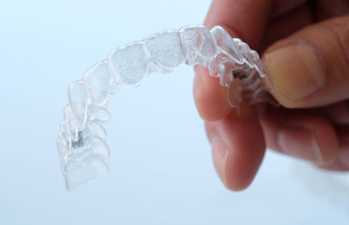 見えない矯正」などの豊富な治療メニュー