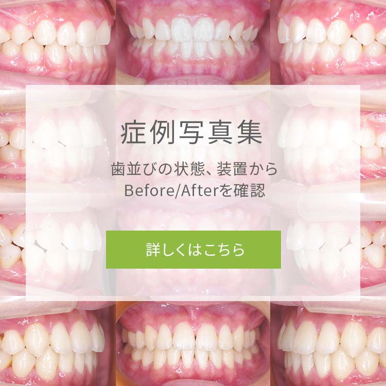 症例写真集