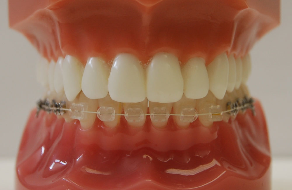 ハーフリンガル