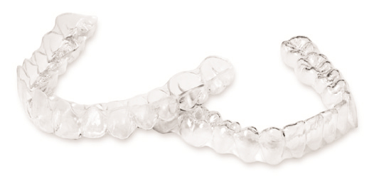 インビザライン