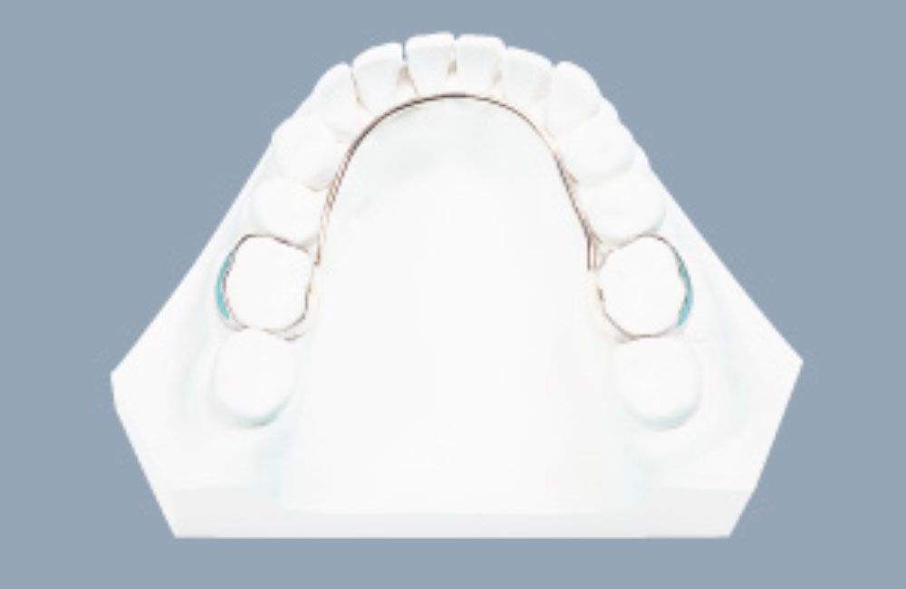 リンガルアーチ