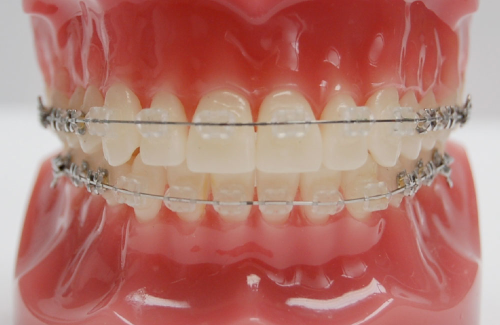 マルチブラケット装置