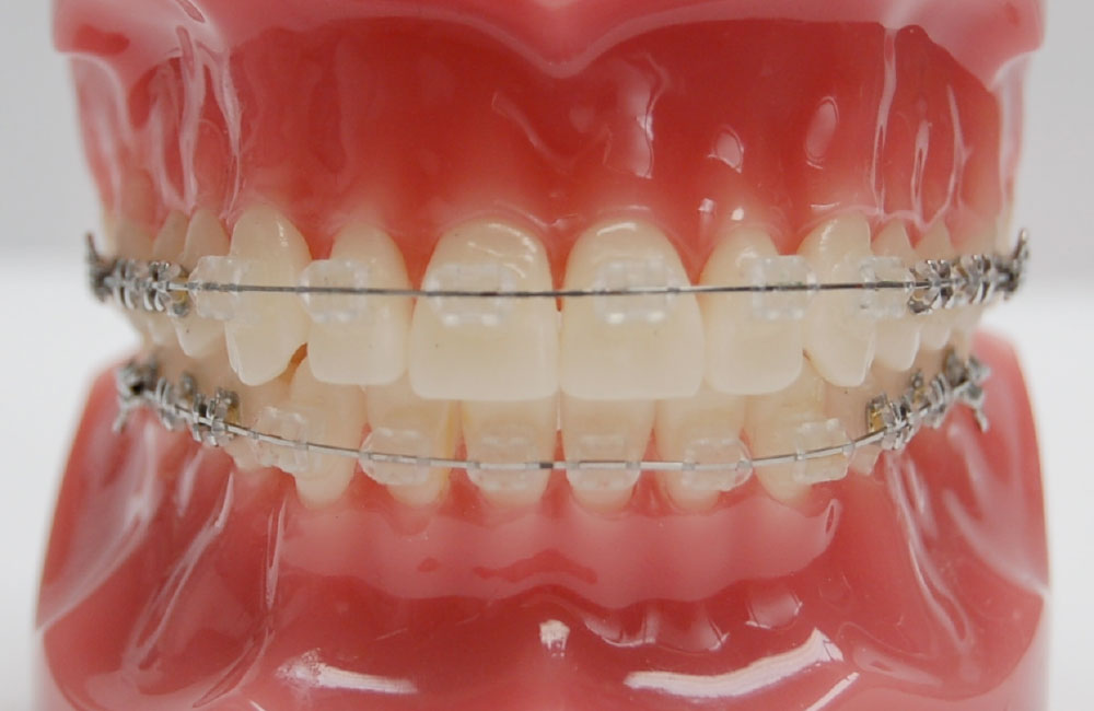 マルチブラケット装置