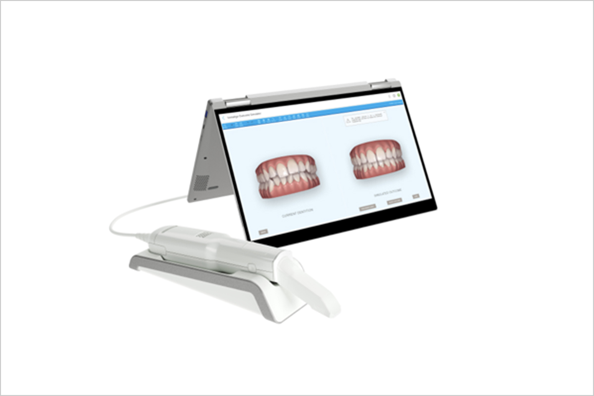 口腔内スキャナ(iTero Element FLEX)とは